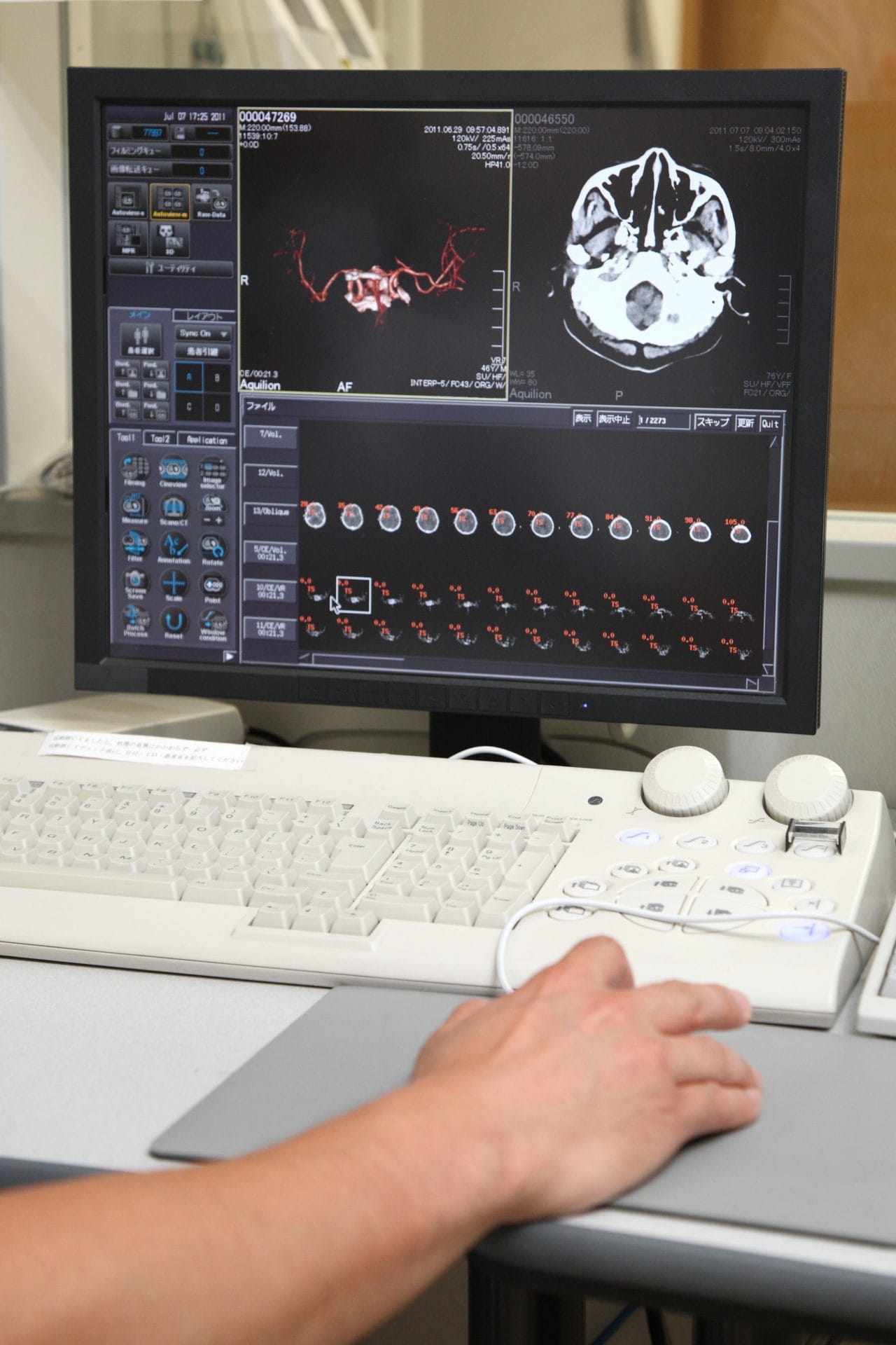 MRI and CT scan differences